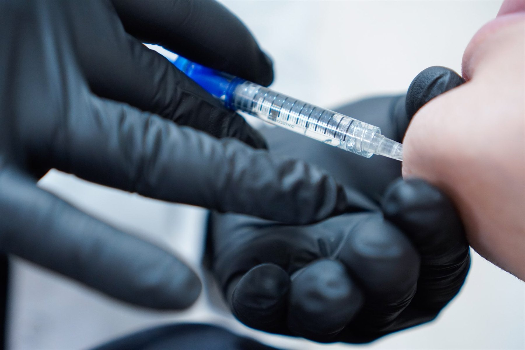 Tratamiento de ácido hialurónico facial en la clínica de medicina estética en Madrid