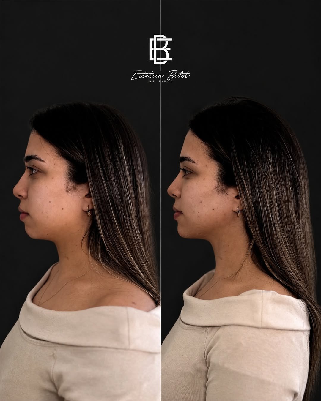 Tratamientos corporales — Estética Bidot Madrid