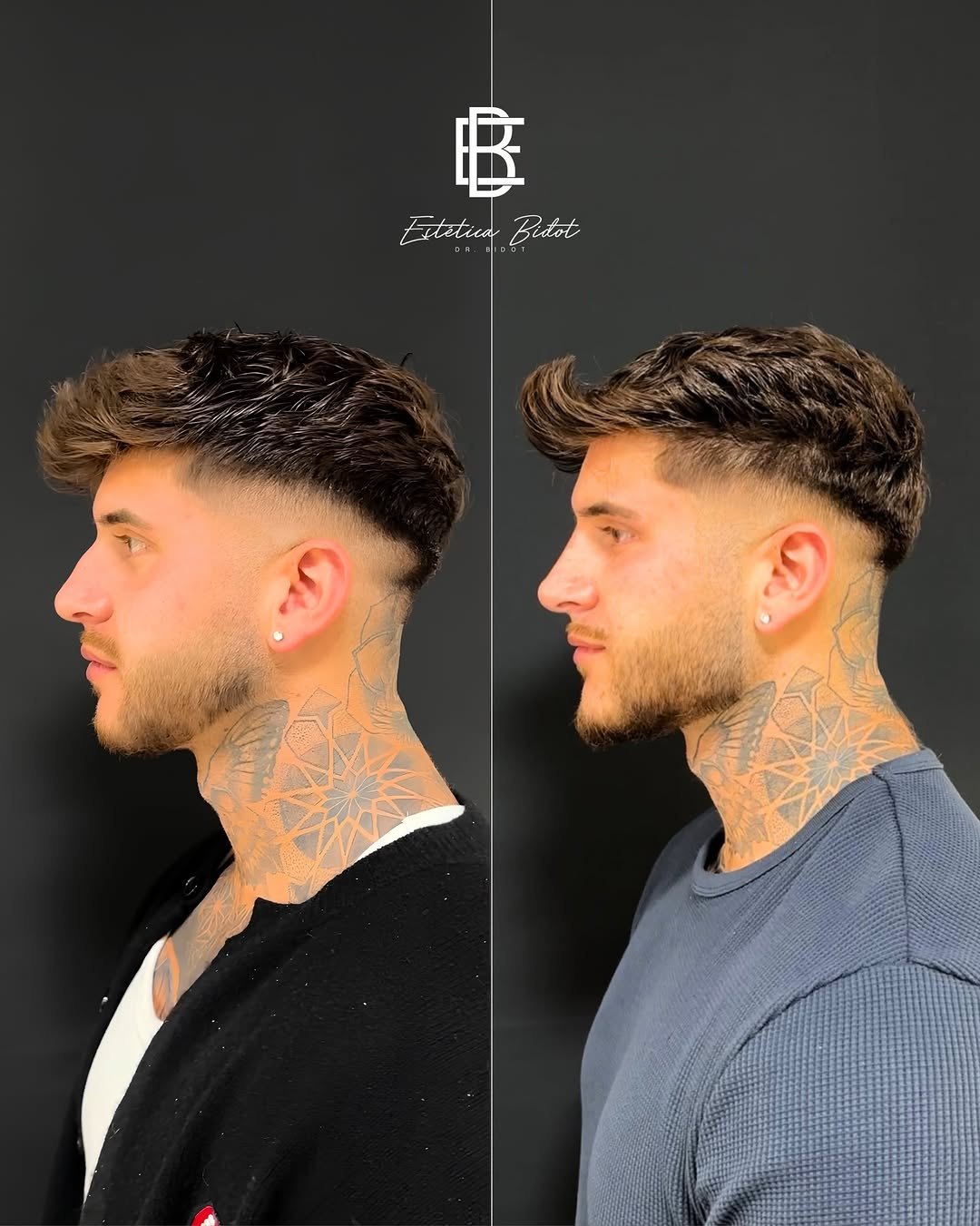 Bioestimulación y colágeno — Estética Bidot Madrid